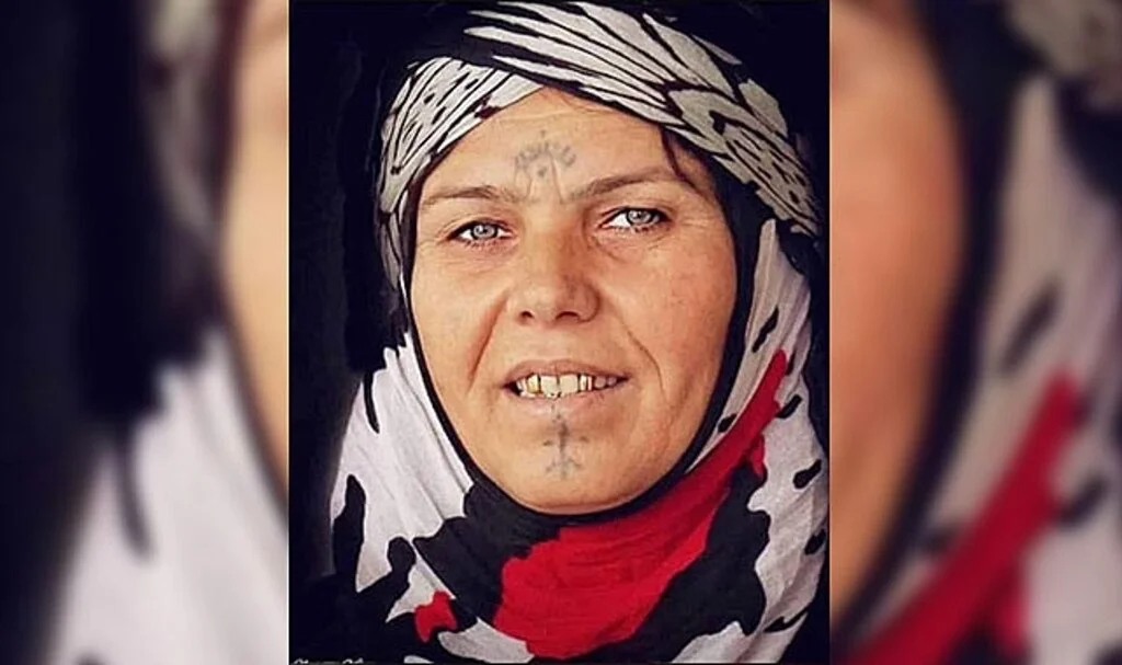 Fıstık bahçesinde otomobilin çarptığı kadın hayatını kaybetti