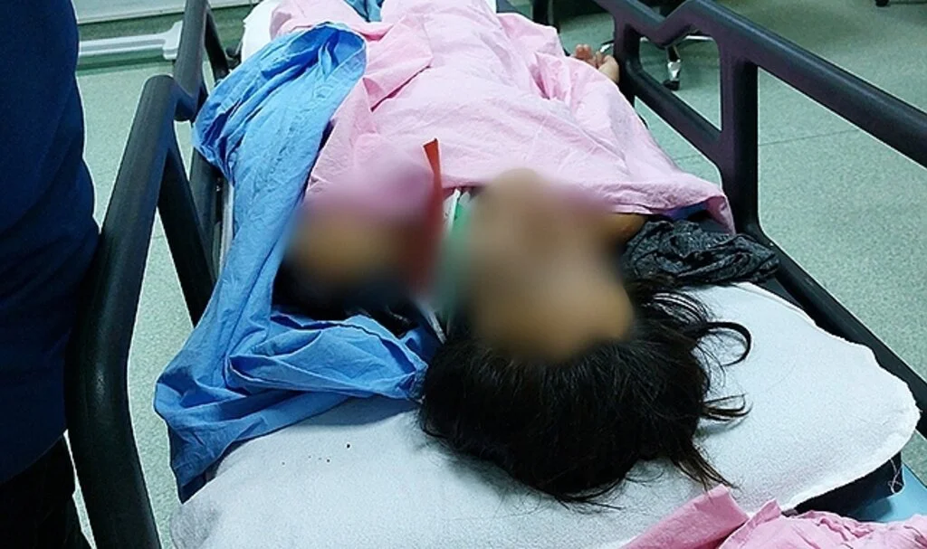 Samsun'da pencereden düşen kadını ölümden büfenin tentesi kurtardı