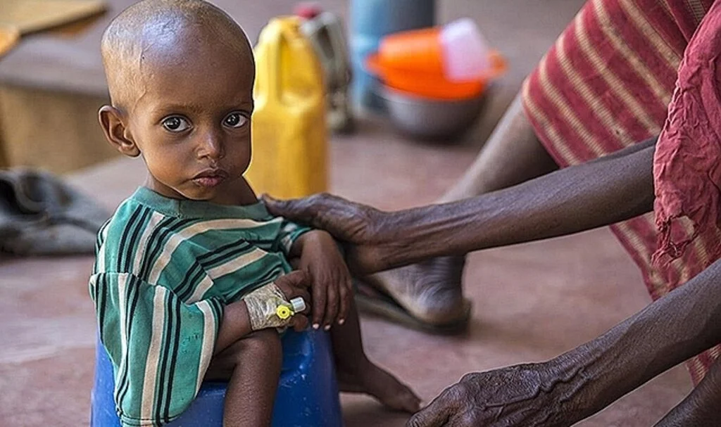 Somali'de gıda sıkıntısı 500 bin çocuğu ölüm riskiyle karşı karşıya bırakıyor