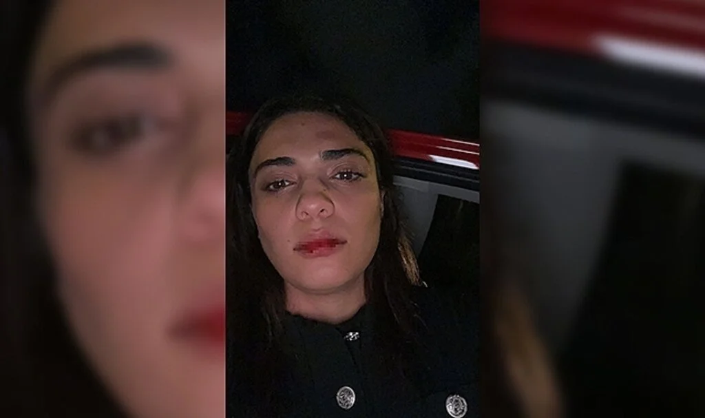 Azerbaycanlı şarkıcı Nergiz Bagieva, İstanbul'da taksicinin saldırısına uğradı