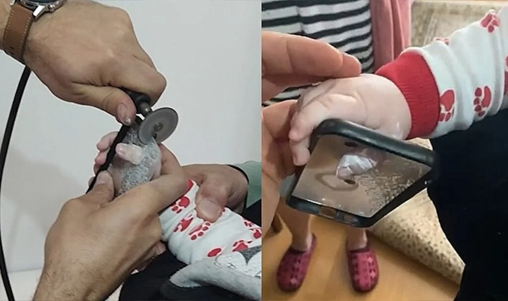 Minik bebeğin parmağı öyle bir yere sıkıştı ki gören şaşkına döndü