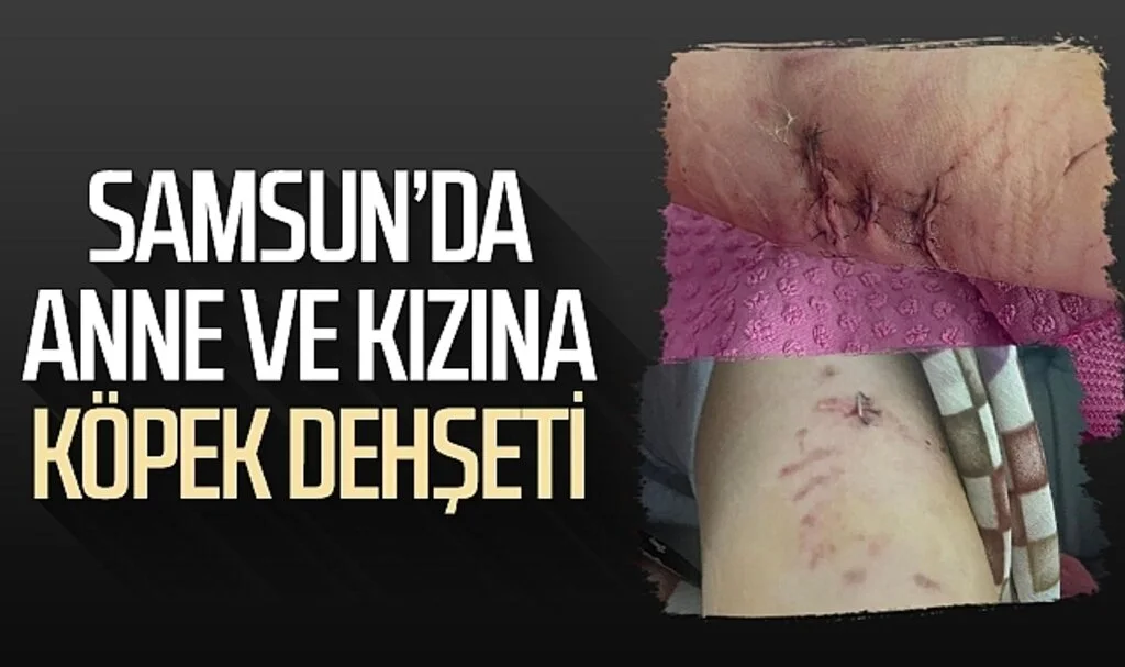 Samsun'da anne ve kızına köpek dehşeti