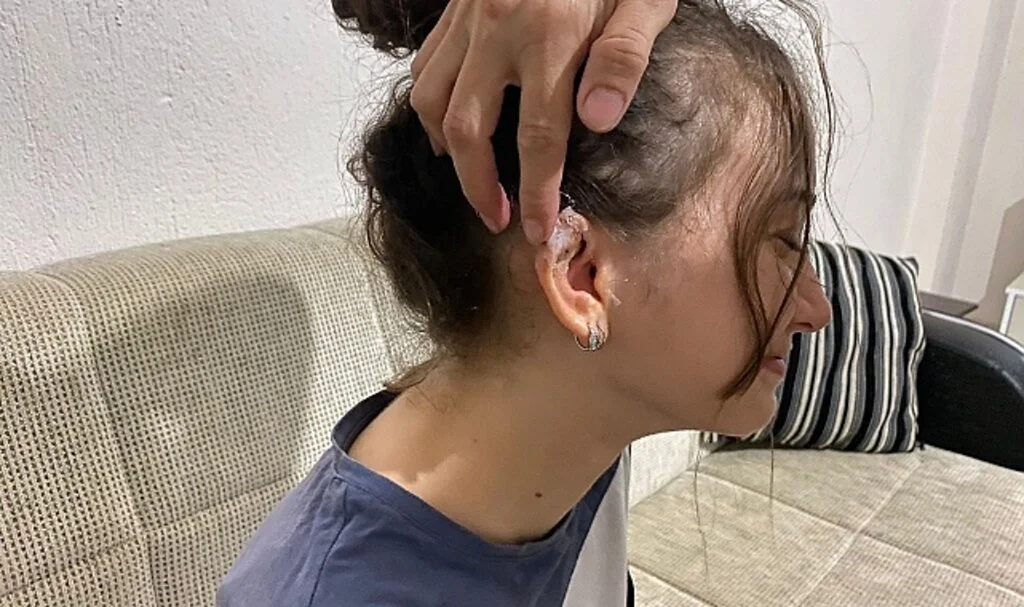 Takıcıda deldirdiği kulağı hayatını kabusa çevirdi