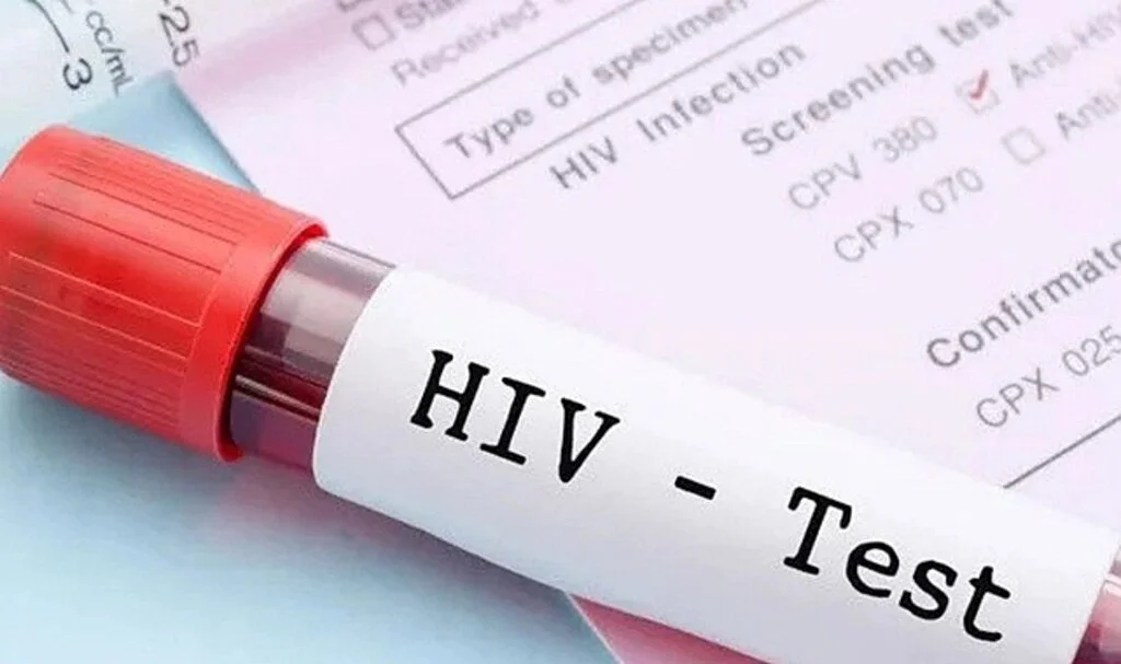 1,5 milyon yeni HIV vakası dünyayı tehdit ediyor