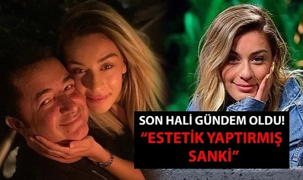 Acun Ilıcalı'nın sevgilisi Ayça Çağla Altunkaya'nın son hali gündem oldu! "Estetik yaptırmış sanki"