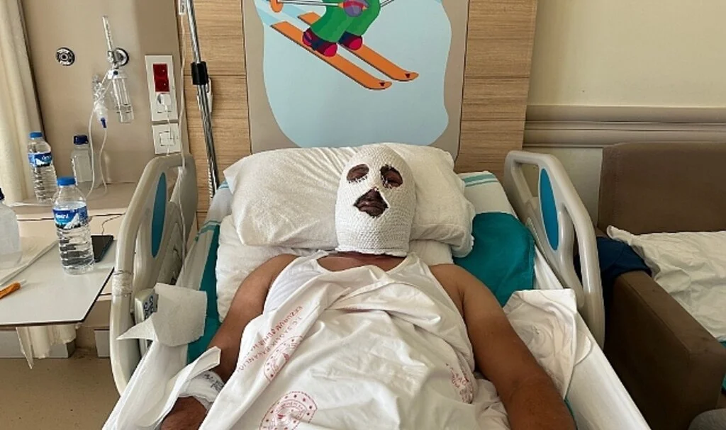 Doğal gaz borusunu tamir etmek için gitti felaketi yaşadı