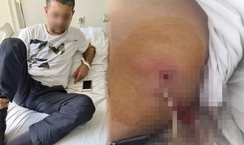 Kamu kurumunda akılalmaz olay! Böbreğini kaybetti, pankreası yandı, kalın bağırsağı kısaltıldı... 'İkinci çocuk hayallerimiz vardı'
