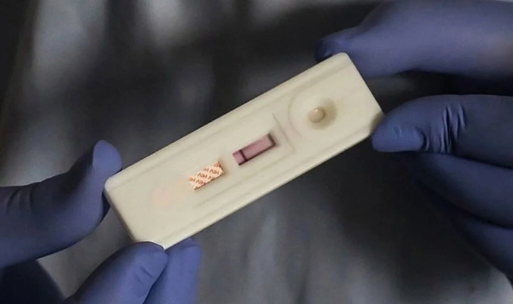 Resmi kayıtlara göre Türkiye'de 32 bin 376 kişi HIV/AIDS ile yaşıyor