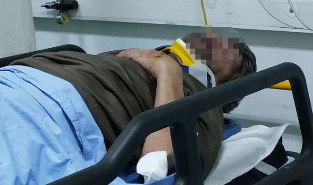 Samsun'da üzerine çatı çöken işçi hastanelik oldu
