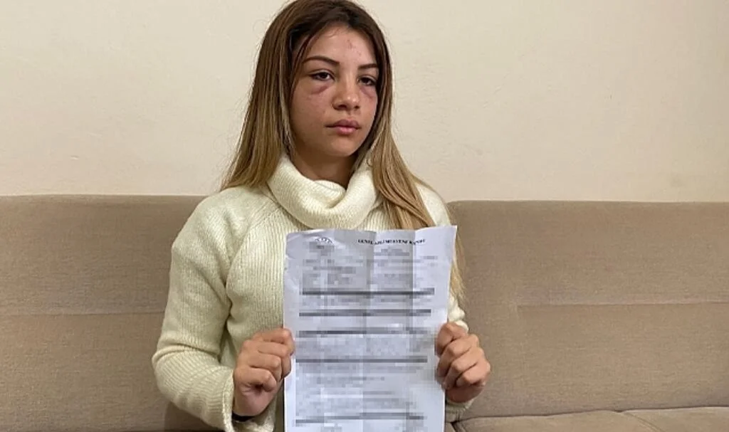 Üsküdar’da koca dehşeti: 4 aylık hamile karısını çocuğunun gözü önünde dövdü