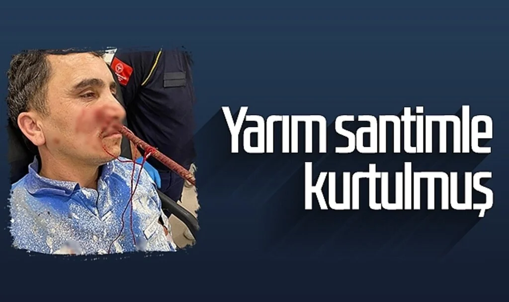 Yüzüne İnşaat Demiri Saplanan İşçi Yarım Santimle Kurtulmuş
