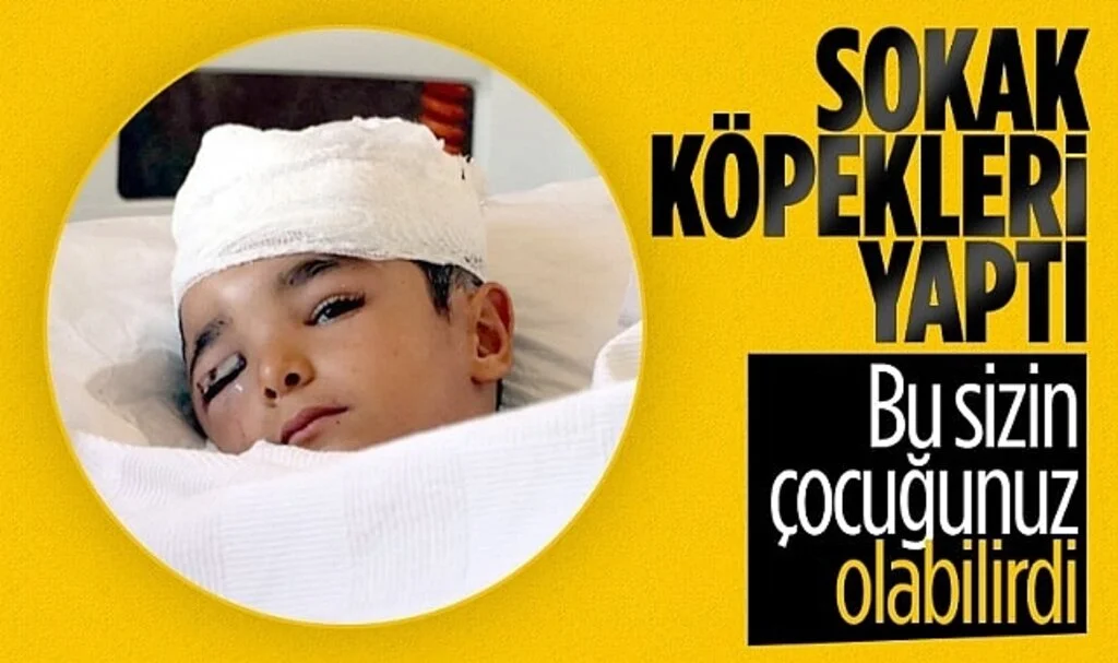 Gaziantep'te Sokak Köpeği Küçük Çocuğun Kafa Derisini Koparttı