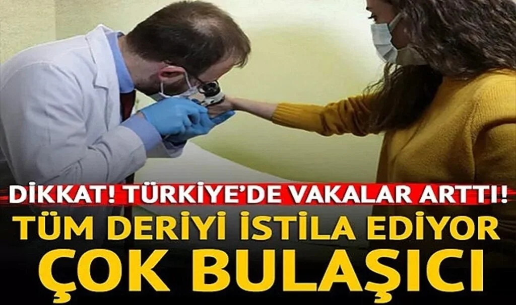 Dikkat! Türkiye'de sayı giderek artıyor... Belirti göstermeden hızlıca bulaşıyor!