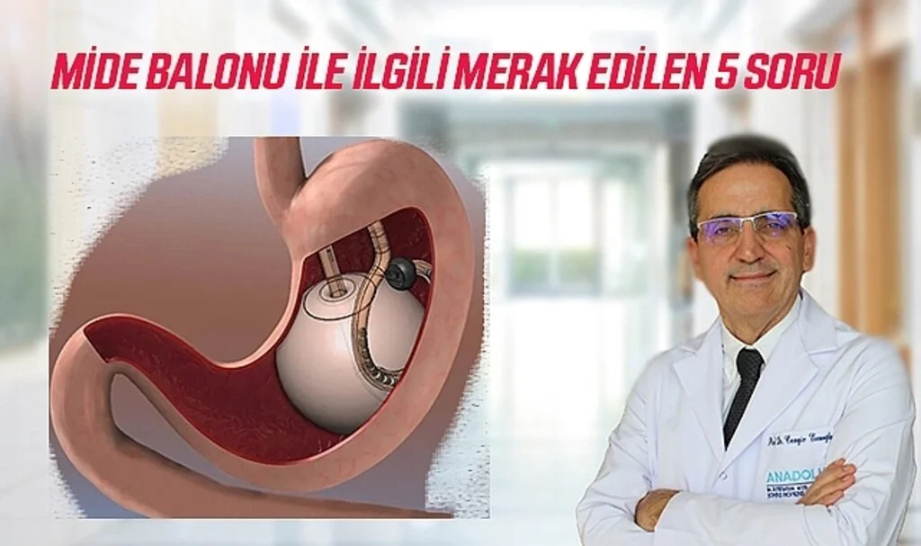 Mide Balonu İle İlgili Merak Edilen 5 Soru