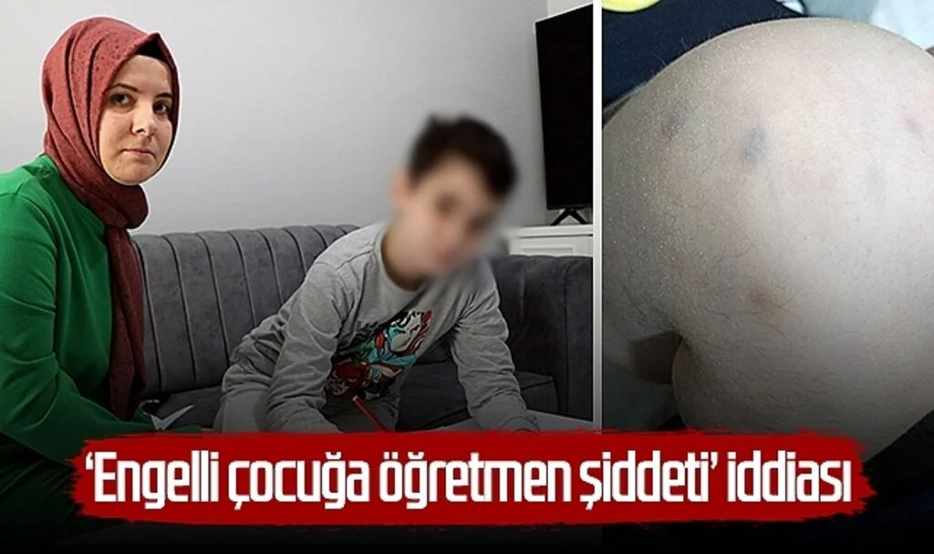 Samsun'da 'engelli çocuğa öğretmen şiddeti’ iddiası
