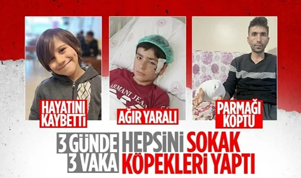 Kastamonu'da komşusunun köpeğinin saldırısına uğradı: Parmağı koptu