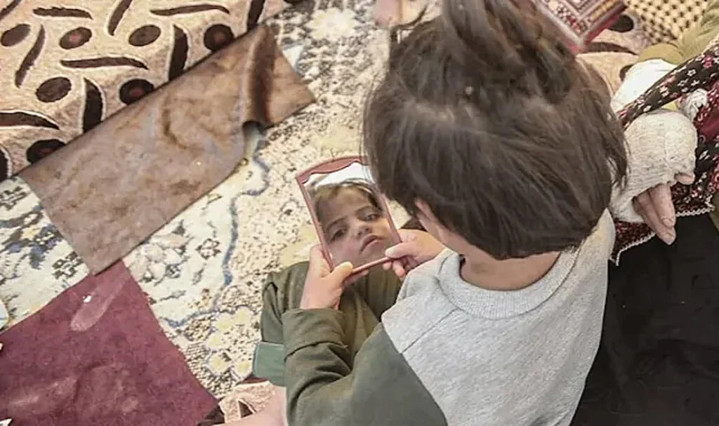 Depremde Ailesini Kaybetti, Artık Konuşamıyor