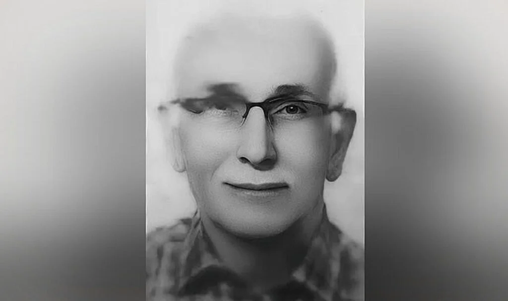 Samsun'da Kazada Yaralanan Emekli Öğretmen Hayatını Kaybetti