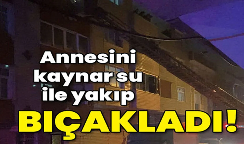 Annesini Kaynar Su ile Yakıp Bıçakladı!
