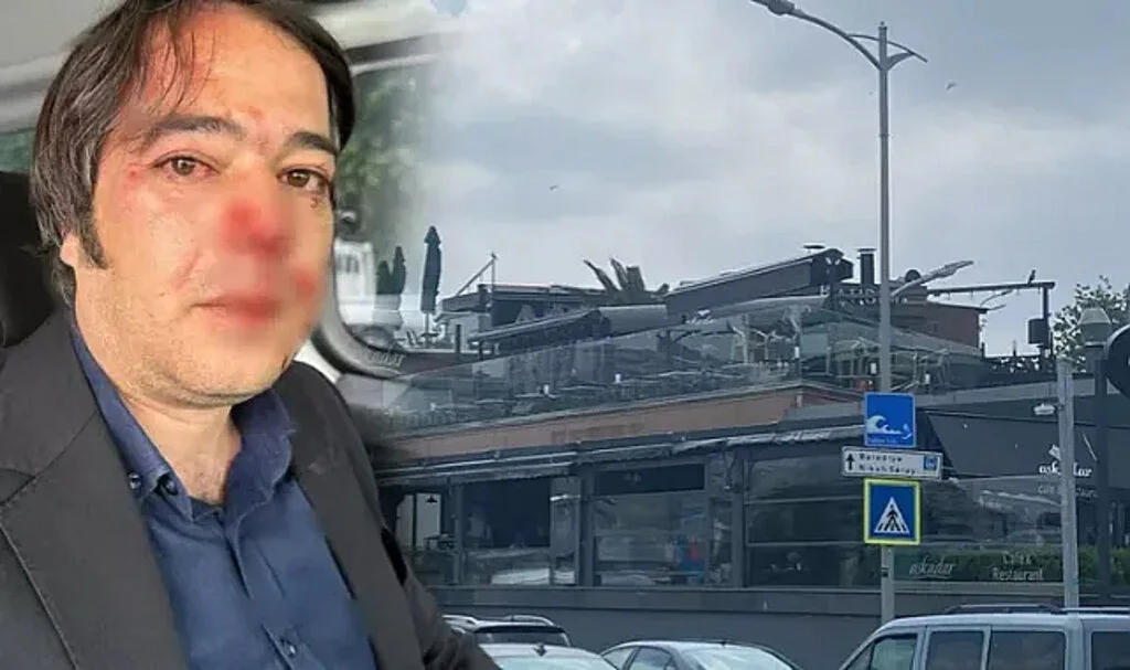 Kaçak Kafeyi Yıkmak İçin Gitmişlerdi, İBB Ekipleri Saldırıya Uğradı! 
