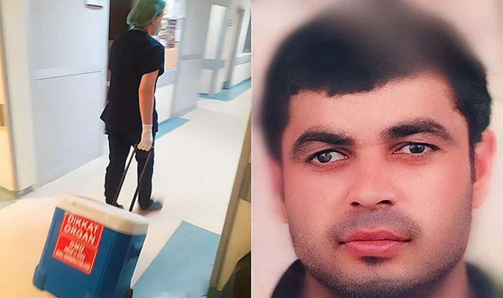 Samsun'da Merdivenden Düşerek Ölen Şahıs Organlarıyla 3 Kişiye Umut Oldu