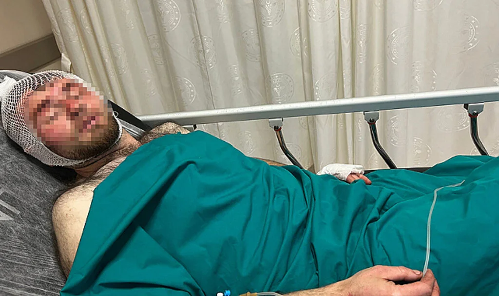 Samsun'da Seyir Halindeki Kamyonetin Kasasından Düşen Kişi Yaralandı