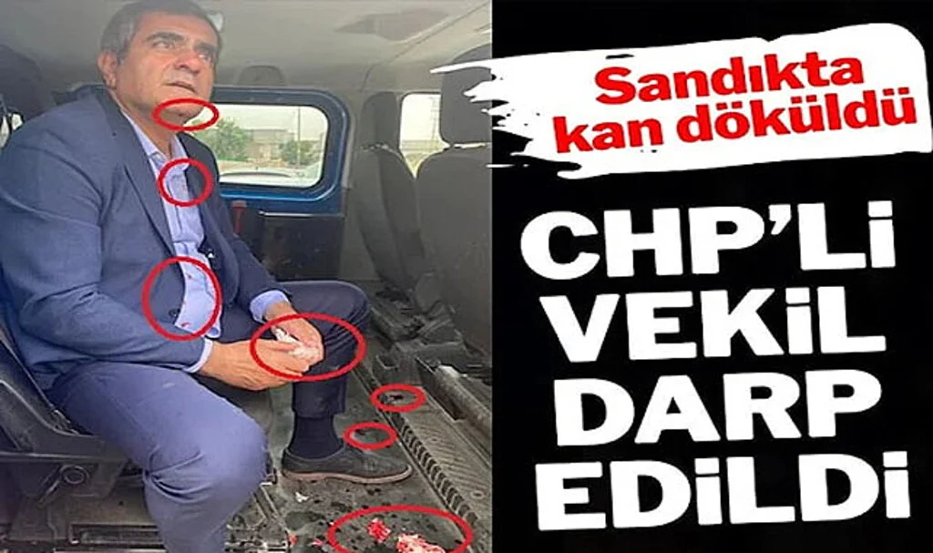 Sandık Usulsüzlüğüne İtiraz Eden CHP’li Vekil Darp Edildi