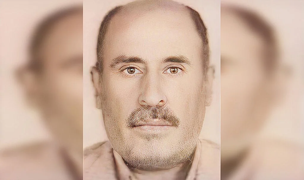 Kazada Yaralanan Yaşlı Adam Hayatını Kaybetti