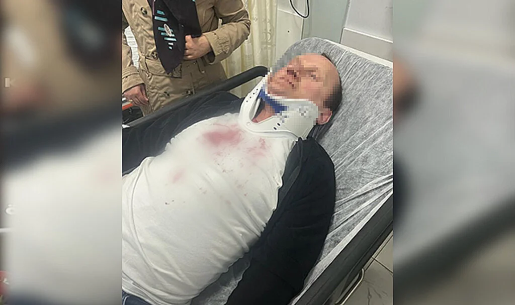 Samsun'da Kırmızı Işıkta Darp Edildi  