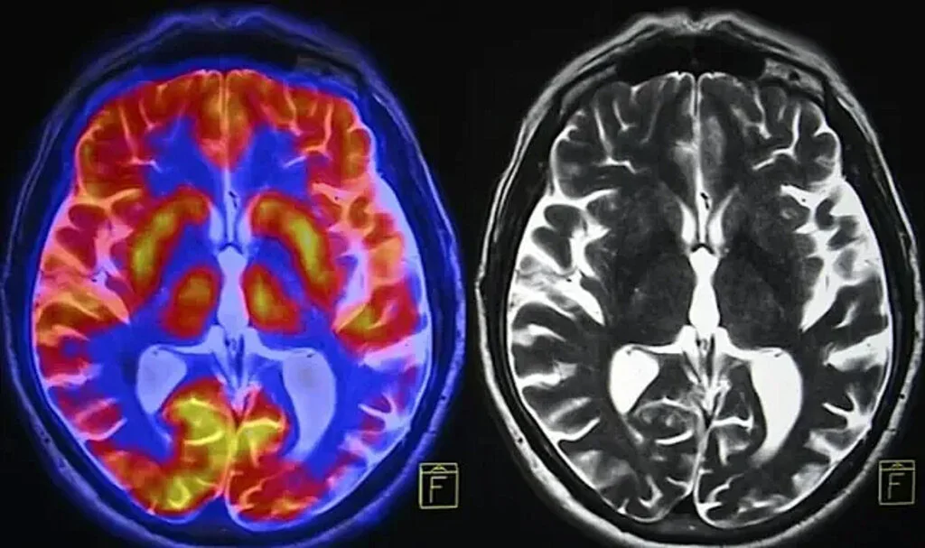 İnsanların Beyni Küçülüyor: IQ Seviyesi Uyarısı Yapıldı