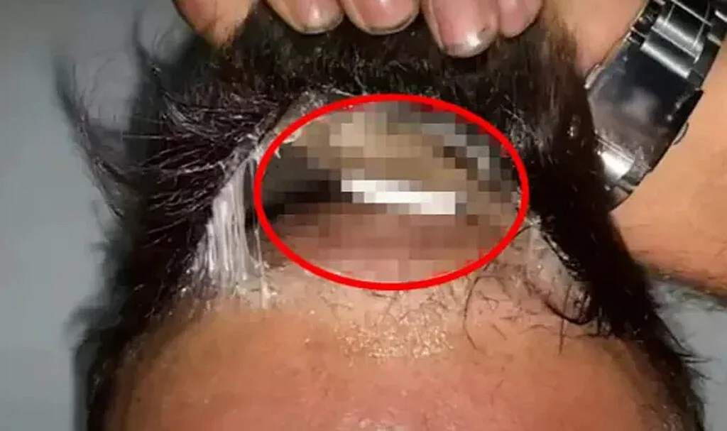 Peruğundan Çıktı, Gören Şaşkına Döndü! Gözaltına Alındı