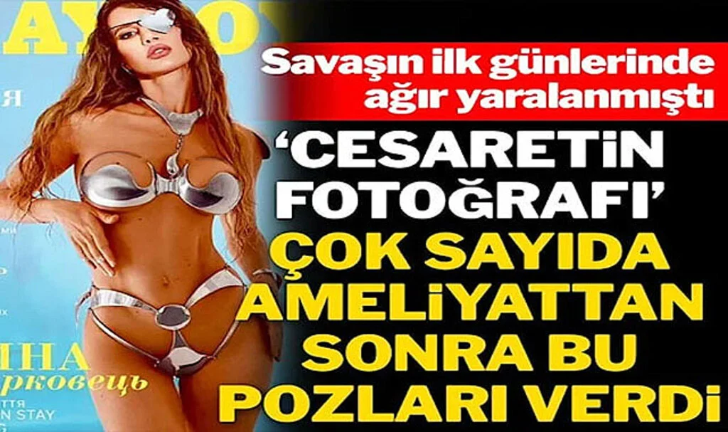 Direnişin Simgesi: Yaralanan Ukraynalı Model, Ünlü Dergiye Kapak Kızı Oldu