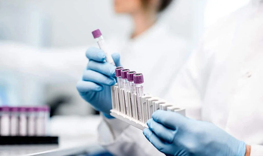 Cinsel Yolla Bulaşan Hastalıklara sebep olan 13 farklı etken mikrobun tanısında kullanılan moleküler test hakkında bilginiz var mı?