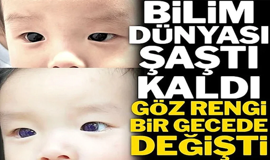 Covid-19 Tedavisi Olan Bebeğin Gözü Kahverengiden Parlak Maviye Döndü