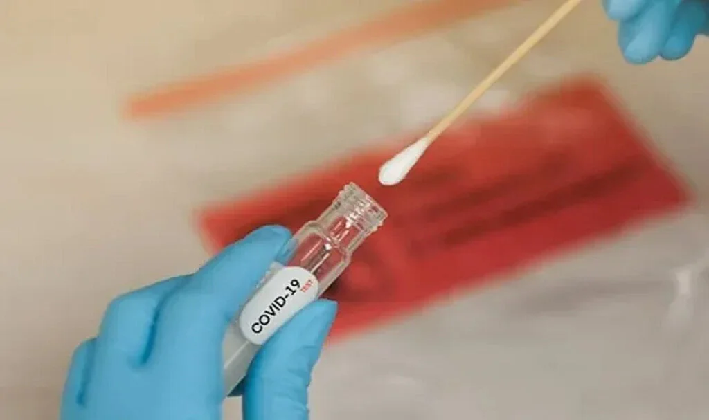 DSÖ: Covid-19 Vakaları Artıyor