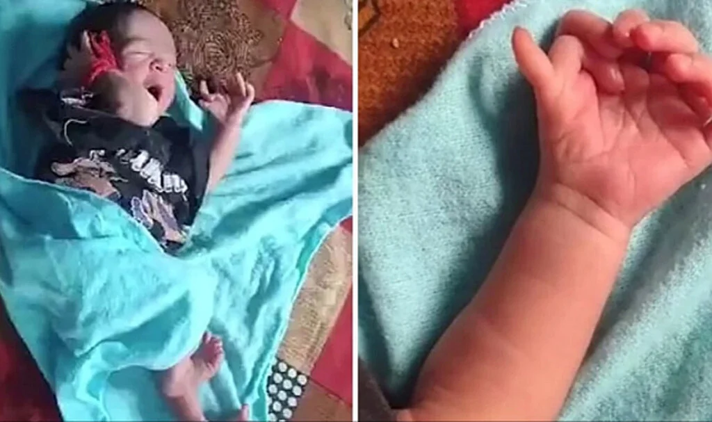 Hindistan'da 26 Parmakla Dünyaya Gelen Bebek Tanrıça Olarak Görülüyor