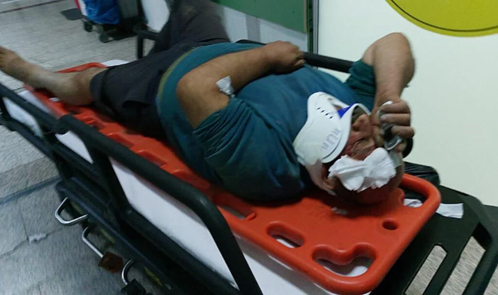 Samsun'da Ormanda Traktör Römorkundan Düştü, Helikopterle Hastaneye Kaldırıldı