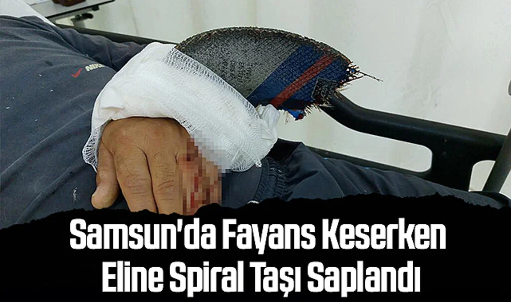 Samsun'da Fayans Keserken Eline Spiral Taşı Saplandı