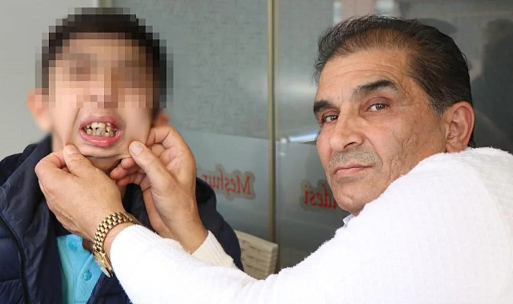 Alt çenesi yok, dişleri üst damağında: Ameliyat için yardım bekliyor