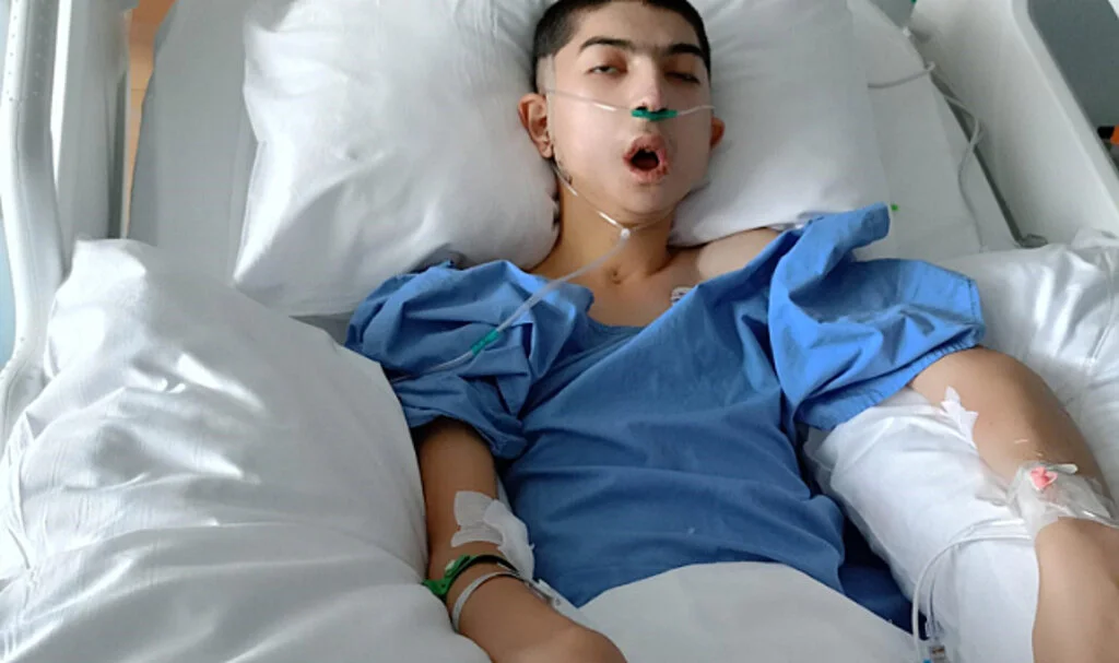 Doğuştan alt çenesi olmayan çocuğa başarılı operasyon: 17 yıl sonra normal yemek yiyebilecek