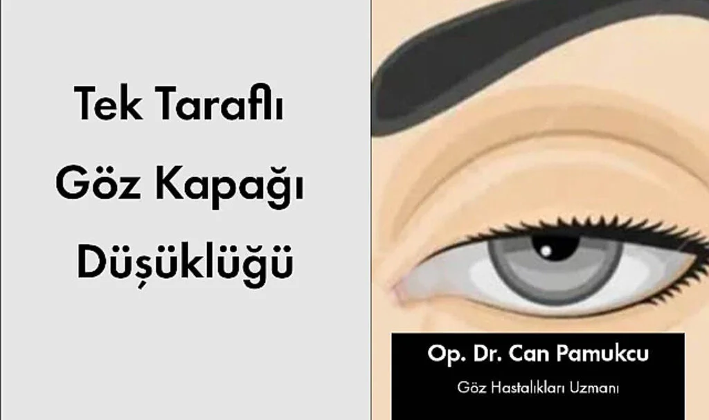Tek Taraflı Göz Kapağı Düşüklüğü Sebepleri, Belirtileri ve Tedavi Yöntemleri