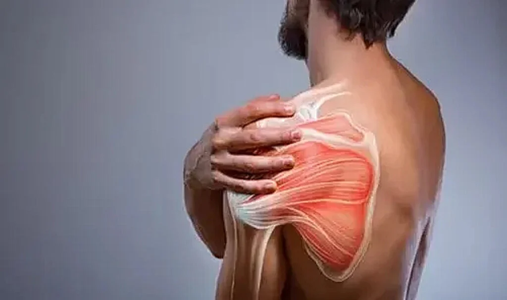 Donuk omuz nedir, belirtileri nelerdir?