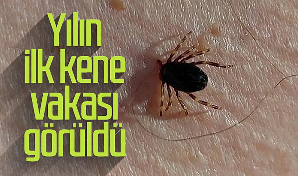Havalar Isındı, Yılın İlk Kene Vakası Görüldü!