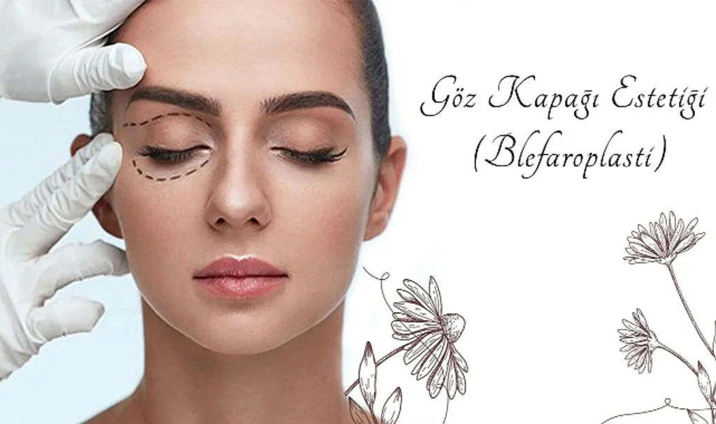 Göz Kapağı Estetiği ile Daha Genç Bir Görünüm