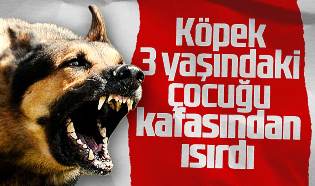 Samsun'da Köpek 3 Yaşındaki Çocuğu Kafasından Isırdı