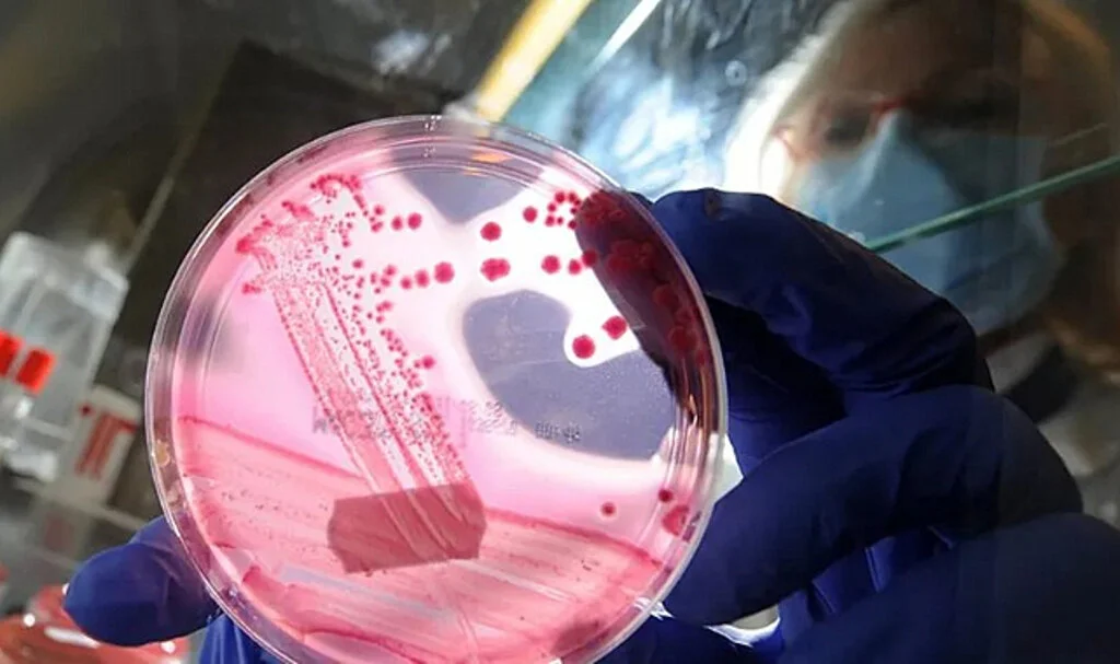 Türk Bilim İnsanından, Gereksiz Antibiyotik Kullanımına Son Verecek İcat