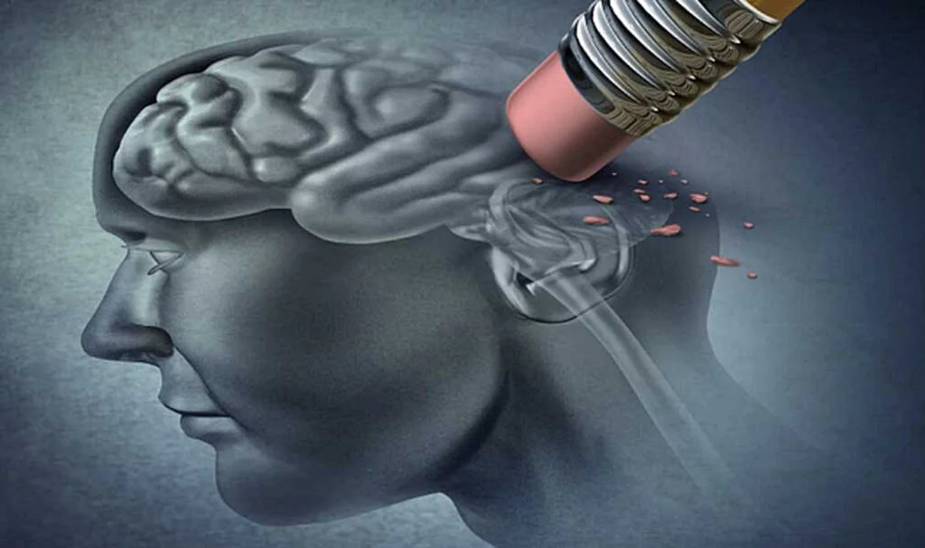 Alzheimer Hastalığı Nedir?