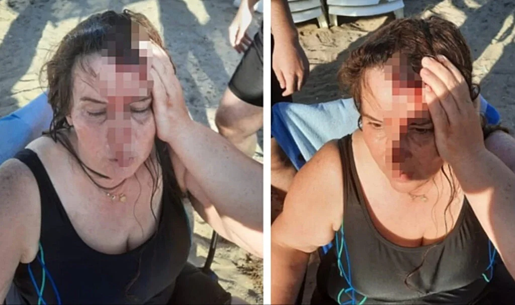 Kocaeli'de Jet Ski Kazası! Yerde Kanlar İçinde Kalan Kadına Küfür Edip Kaçtı