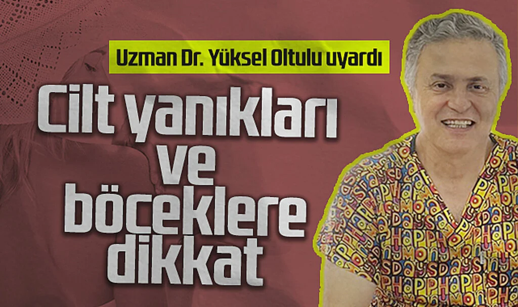 Uzman Dr. Yüksel Oltulu uyardı: Cilt Yanıkları Ve Böceklere Dikkat