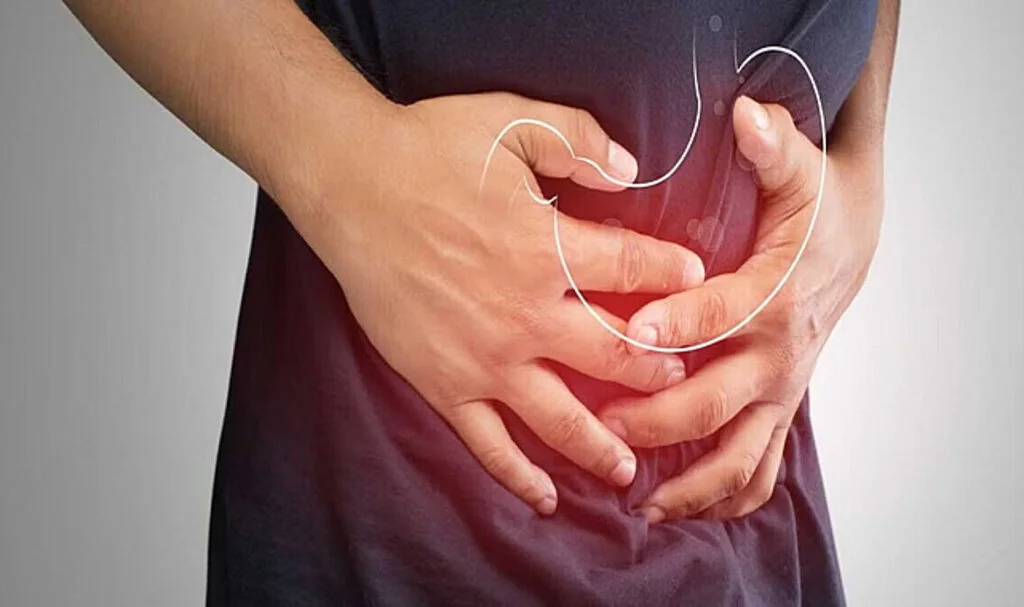 Mide Ekşimesi Nedir ve Nasıl Önlenir?